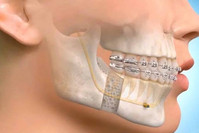 General Dental Care
