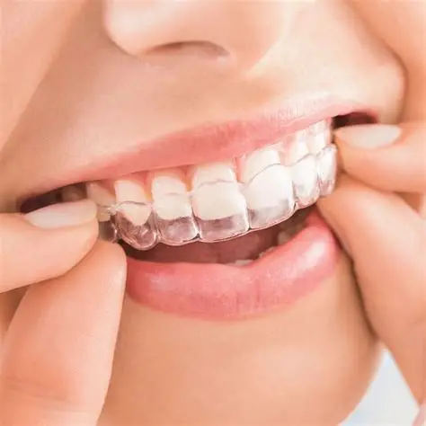 Invisalign
